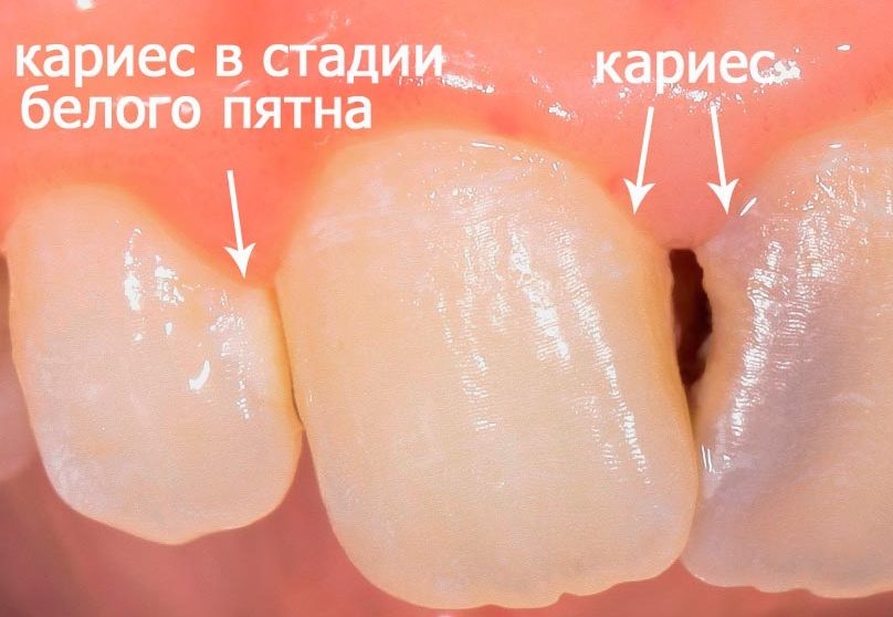По каким причинам необходимо регулярное посещение стоматологической клиники